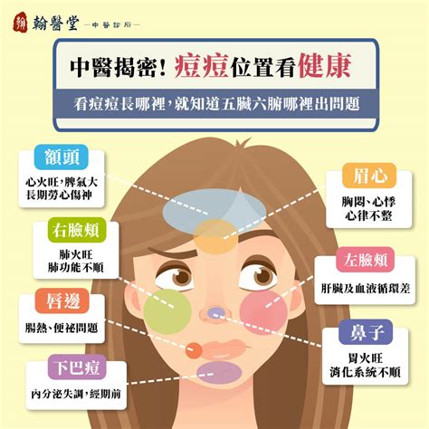 痘痘 位置|額頭、下巴狂長痘痘？痘痘位置反映的健康問題與保養對策